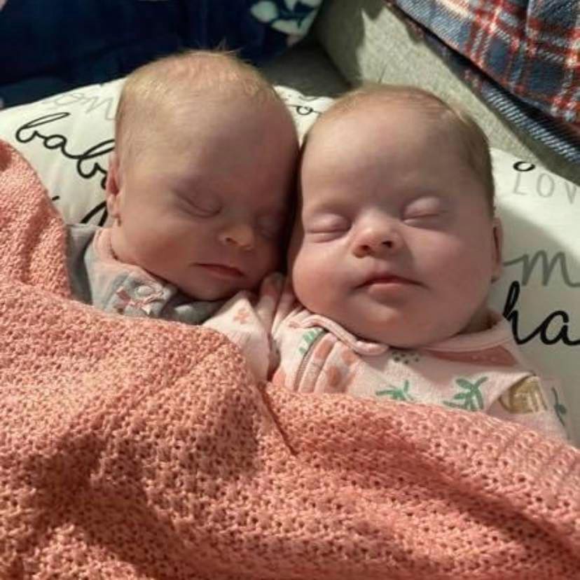 To silence detractors, the mother of unusual twins with Down syndrome demonstrates how beautiful and precious they are.