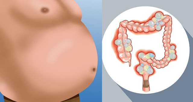 YOU ARE NOT OVERWEIGHT! Your Stomach Is Bloated, and Here’s What You Can Do About It!!