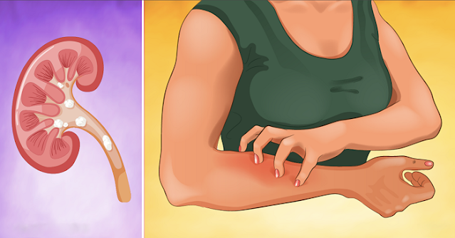 If Your Kidney Is in Danger, Your Body Will Alert You With These 8 Symptoms!