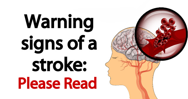 Warning signs of a stroke – PLEASE READ