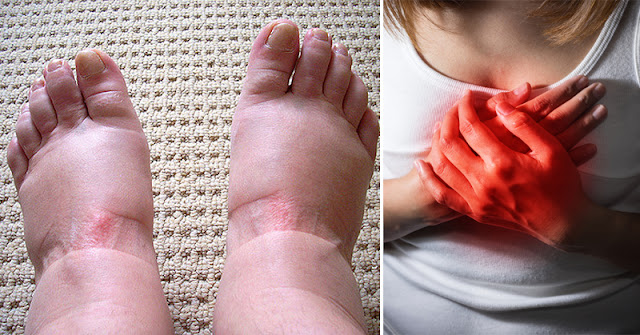 There are nine scary warning symptoms of swollen feet that you should never overlook.