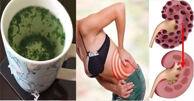 This Natural Home Cocktail Can Cleanse Your Kidneys Almost Quickly.