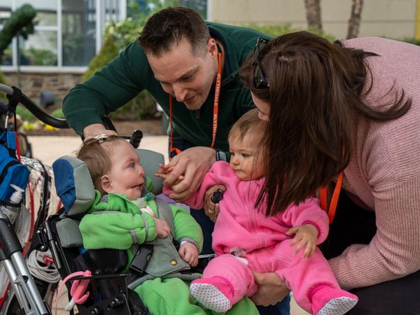 For the First Time, a Girl Meets Her 11-Month-Old Identical Twin Sister Born with Rare Condition: ‘Very Emotional’