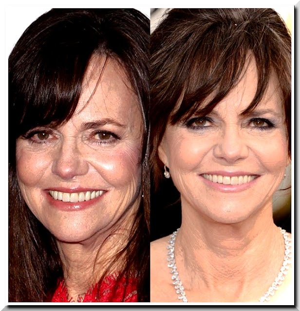 Sally Field feels “young again” after undergoing face surgery because her “age” has left her “anonymous.”