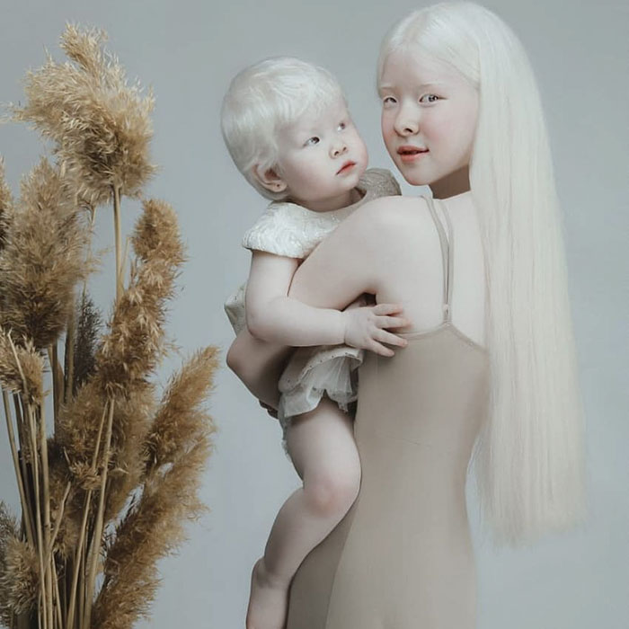 Despite being born more than a decade apart, these siblings have something special.Albino sisters born 12 years apart astound the entire world with their exceptional beauty.