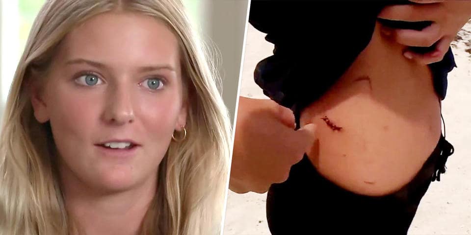 After being bitten in the arms, leg, and stomach by a shark, a 13-year-old girl recalls fighting it off.