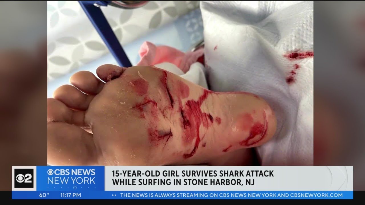 Teenage surfer in New Jersey survives shark attack: “My whole foot was in its mouth”