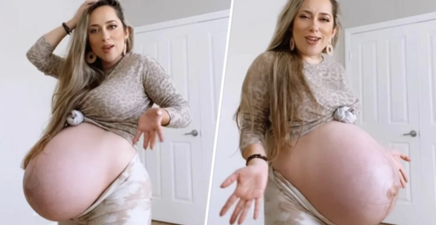 Embracing Pregnancy and Defying Body-Shaming